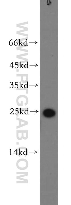 SFTPC Rabbit anti-Human, Rat, Polyclonal, Proteintech:Antibodies:Primary