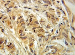 ACOT11 Rabbit anti-Human, Mouse, Rat, Polyclonal, Proteintech
