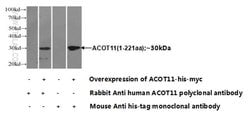 ACOT11 Rabbit anti-Human, Mouse, Rat, Polyclonal, Proteintech:Antibodies:Primary