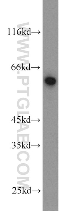 Proteintech Dopamine beta Hydroxylase Rabbit anti-Human, Polyclonal, Proteintech
