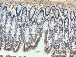 Bcl-XL Rabbit anti-Human, Mouse, Rat, Polyclonal, Proteintech:Antibodies:Primary