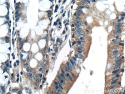 Bcl-XL Rabbit anti-Human, Mouse, Rat, Polyclonal, Proteintech:Antibodies:Primary