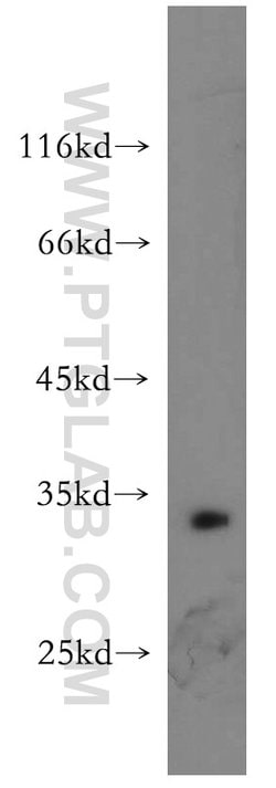 Bcl-XL Rabbit anti-Human, Mouse, Rat, Polyclonal, Proteintech:Antibodies:Primary