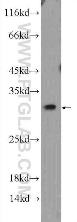 Bcl-XL Rabbit anti-Human, Mouse, Rat, Polyclonal, Proteintech:Antibodies:Primary