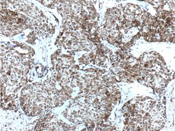 Bcl-XL Rabbit anti-Human, Mouse, Rat, Polyclonal, Proteintech:Antibodies:Primary