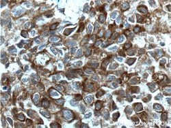 Bcl-XL Rabbit anti-Human, Mouse, Rat, Polyclonal, Proteintech:Antibodies:Primary