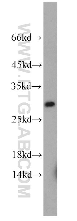 RAB3C Rabbit anti-Human, Mouse, Polyclonal, Proteintech 150 &mu;L | Buy Online | Proteintech | Fisher Scientific