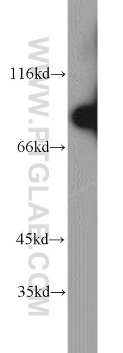 REC8 Rabbit anti-Human, Mouse, Polyclonal, Proteintech:Antibodies:Primary