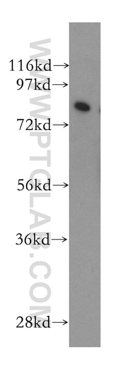 Proteintech REC8 Rabbit anti-Human, Mouse, Polyclonal, Proteintech