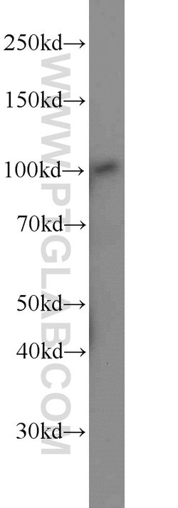 MTHFD1 Rabbit anti-Human, Mouse, Polyclonal, Proteintech:Antibodies:Primary