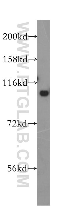 MTHFD1 Rabbit anti-Human, Mouse, Polyclonal, Proteintech:Antibodies:Primary