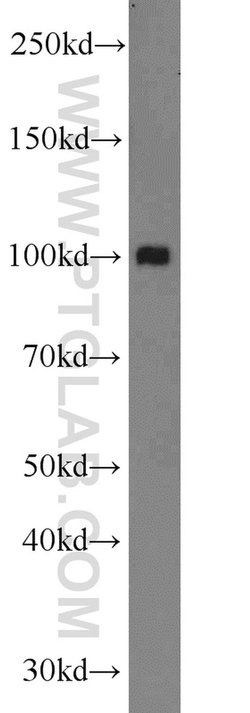 MTHFD1 Rabbit anti-Human, Mouse, Polyclonal, Proteintech:Antibodies:Primary