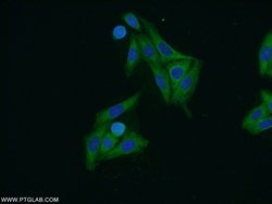 ARF3 Rabbit anti-Human, Mouse, Rat, Polyclonal, Proteintech:Antibodies:Primary