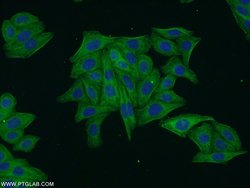 ARF3 Rabbit anti-Human, Mouse, Rat, Polyclonal, Proteintech:Antibodies:Primary