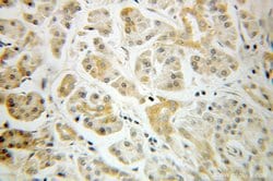 ARF3 Rabbit anti-Human, Mouse, Rat, Polyclonal, Proteintech:Antibodies:Primary