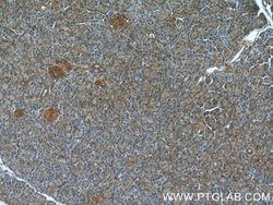 ARF3 Rabbit anti-Human, Mouse, Rat, Polyclonal, Proteintech:Antibodies:Primary