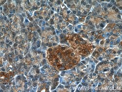 ARF3 Rabbit anti-Human, Mouse, Rat, Polyclonal, Proteintech:Antibodies:Primary