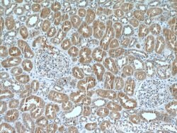 ARF3 Rabbit anti-Human, Mouse, Rat, Polyclonal, Proteintech:Antibodies:Primary