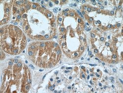 ARF3 Rabbit anti-Human, Mouse, Rat, Polyclonal, Proteintech:Antibodies:Primary