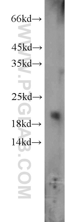 ARF3 Rabbit anti-Human, Mouse, Rat, Polyclonal, Proteintech:Antibodies:Primary