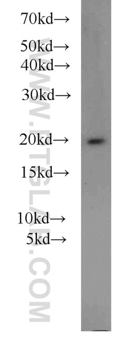 ARF3 Rabbit anti-Human, Mouse, Rat, Polyclonal, Proteintech:Antibodies:Primary
