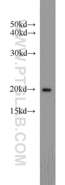 ARF3 Rabbit anti-Human, Mouse, Rat, Polyclonal, Proteintech:Antibodies:Primary