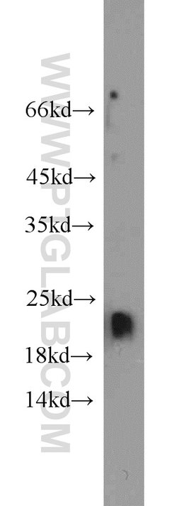 ARF3 Rabbit anti-Human, Mouse, Rat, Polyclonal, Proteintech:Antibodies:Primary