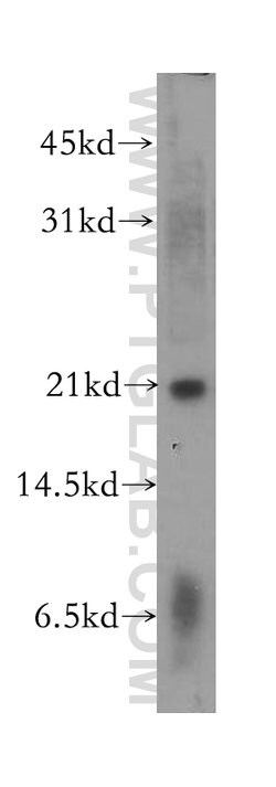 ARF3 Rabbit anti-Human, Mouse, Rat, Polyclonal, Proteintech:Antibodies:Primary
