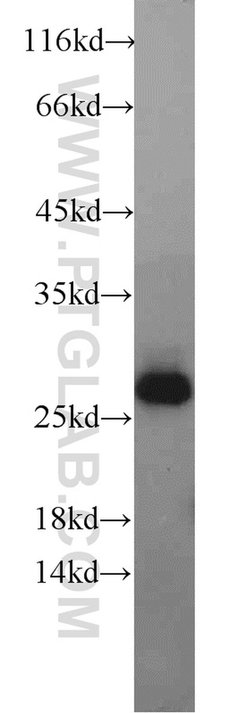 Geminin Rabbit anti-Human, Mouse, Rat, Polyclonal, Proteintech