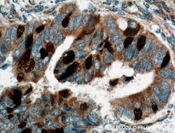 Geminin Rabbit anti-Human, Mouse, Rat, Polyclonal, Proteintech:Antibodies:Primary