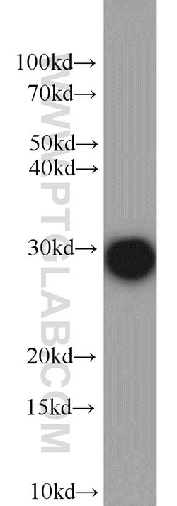 Geminin Rabbit anti-Human, Mouse, Rat, Polyclonal, Proteintech:Antibodies:Primary
