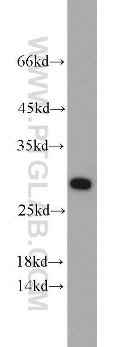 Geminin Rabbit anti-Human, Mouse, Rat, Polyclonal, Proteintech:Antibodies:Primary