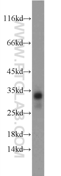 Geminin Rabbit anti-Human, Mouse, Rat, Polyclonal, Proteintech:Antibodies:Primary