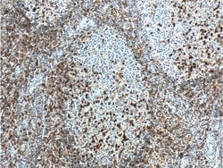 CD69 Rabbit anti-Human, Polyclonal, Proteintech:Antibodies:Primary Antibodies