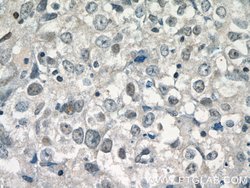 DDX5/p68 Rabbit anti-Human, Mouse, Rat, Polyclonal, Proteintech 150 &mu;L;
