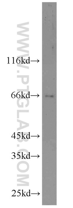 DDX5/p68 Rabbit anti-Human, Mouse, Rat, Polyclonal, Proteintech 150 &mu;L;