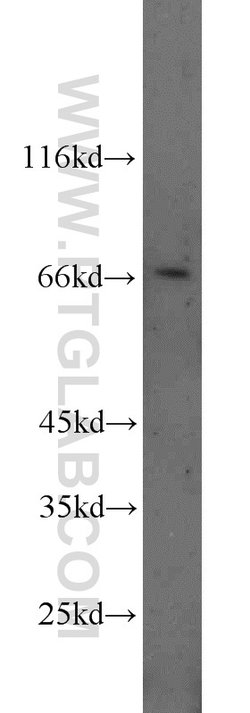DDX5/p68 Rabbit anti-Human, Mouse, Rat, Polyclonal, Proteintech 150 &mu;L;