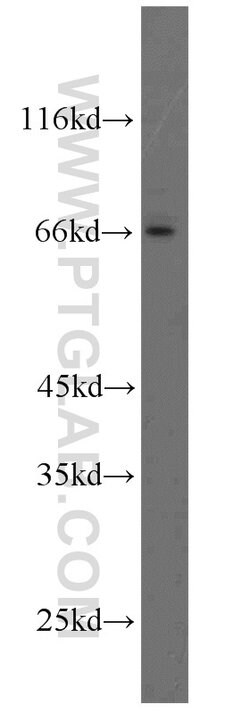 DDX5/p68 Rabbit anti-Human, Mouse, Rat, Polyclonal, Proteintech 150 &mu;L;