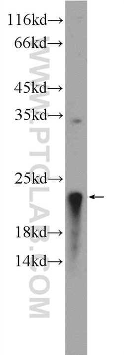 EEF1E1 Rabbit anti-Human, Mouse, Rat, Polyclonal, Proteintech:Antibodies:Primary
