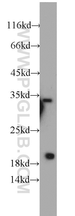 EEF1E1 Rabbit anti-Human, Mouse, Rat, Polyclonal, Proteintech:Antibodies:Primary