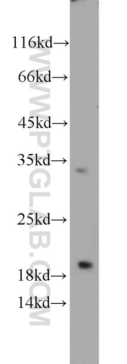 EEF1E1 Rabbit anti-Human, Mouse, Rat, Polyclonal, Proteintech:Antibodies:Primary