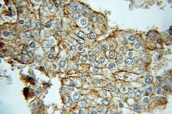 Kallikrein 2 Rabbit anti-Human, Mouse, Polyclonal, Proteintech 150 &mu;L;
