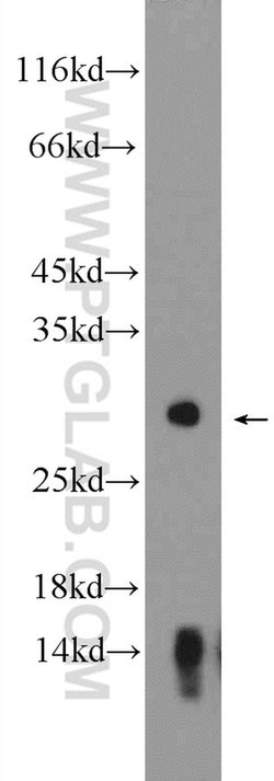 Kallikrein 2 Rabbit anti-Human, Mouse, Polyclonal, Proteintech 150 &mu;L;