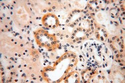 HERP Rabbit anti-Human, Polyclonal, Proteintech 20 &mu;L; Unconjugated:Antibodies,