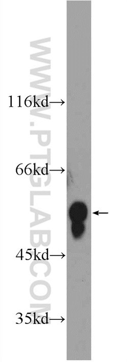 HERP Rabbit anti-Human, Polyclonal, Proteintech 20 &mu;L; Unconjugated:Antibodies,