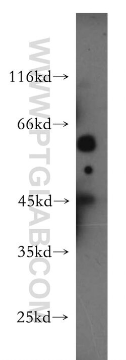 HERP Rabbit anti-Human, Polyclonal, Proteintech 20 &mu;L; Unconjugated:Antibodies,