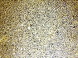 ERCC2 Rabbit anti-Human, Polyclonal, Proteintech:Antibodies:Primary Antibodies