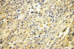 ERCC2 Rabbit anti-Human, Polyclonal, Proteintech:Antibodies:Primary Antibodies