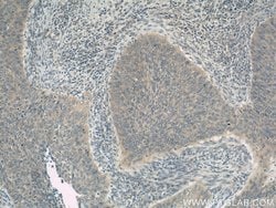 ERCC2 Rabbit anti-Human, Polyclonal, Proteintech:Antibodies:Primary Antibodies