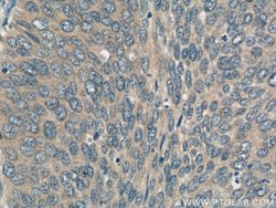 ERCC2 Rabbit anti-Human, Polyclonal, Proteintech:Antibodies:Primary Antibodies